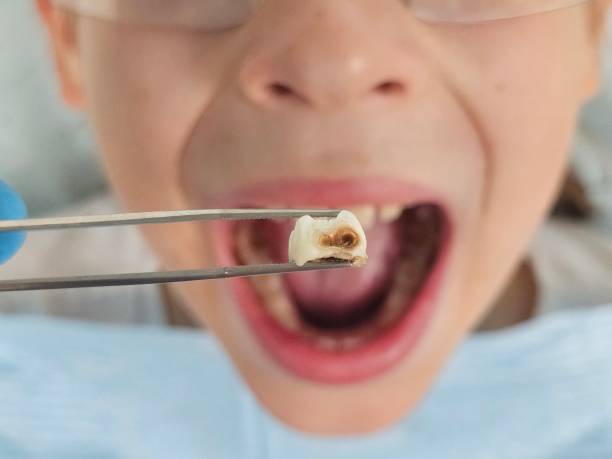 Best Weekend Emergency Dentist in Hainesvle, IL
